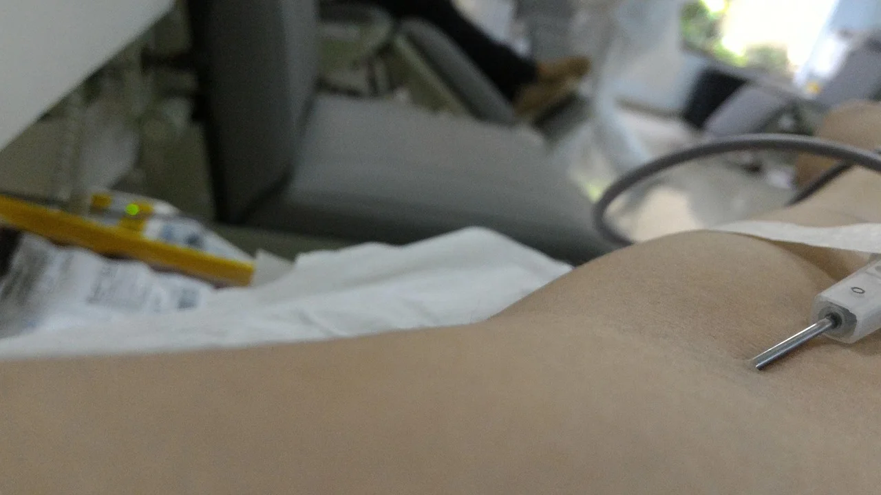 Lanche e hidratação após a doação de sangue