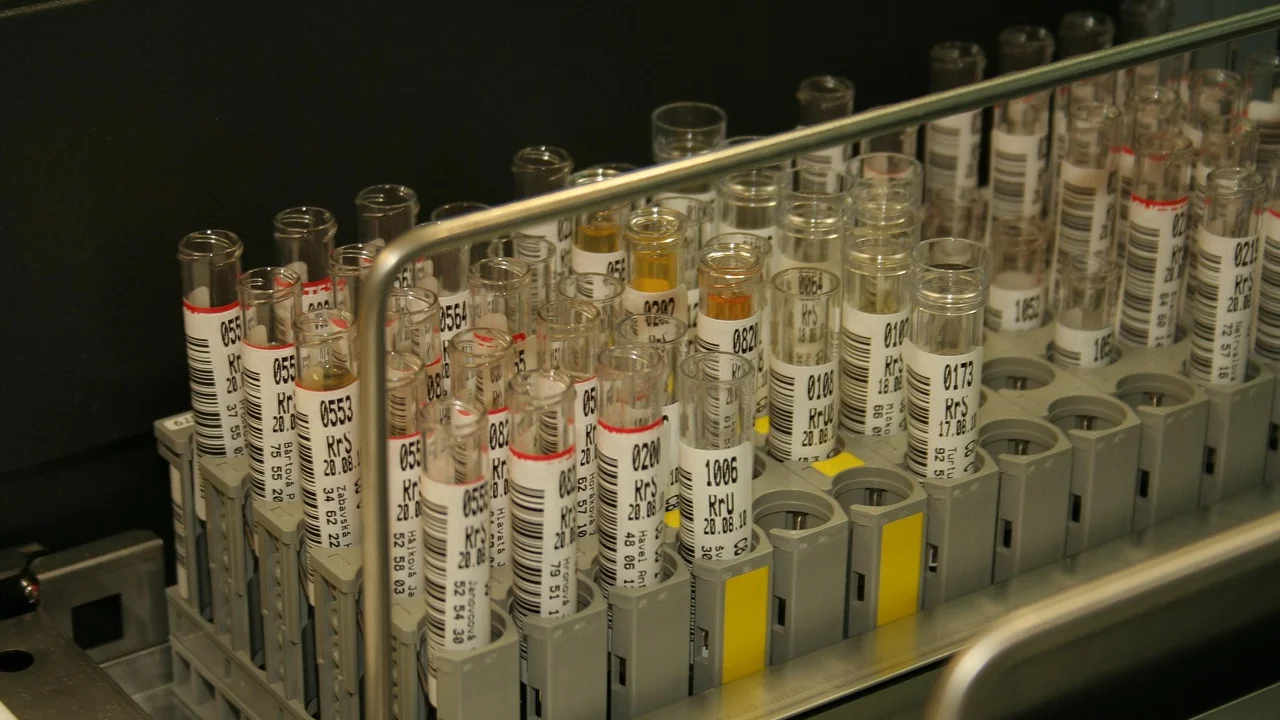 Profissional analisa uma amostra durante exame laboratorial.