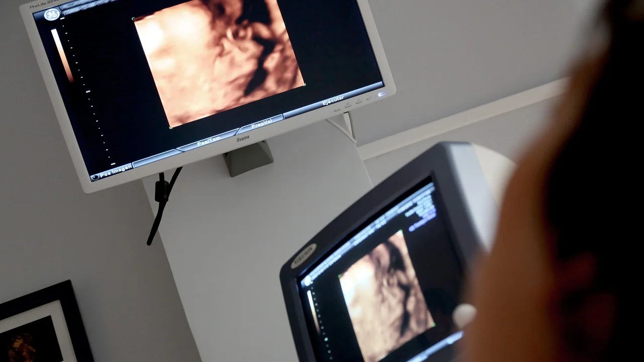 Tela do aparelho mostra imagens obtidas durante o exame.