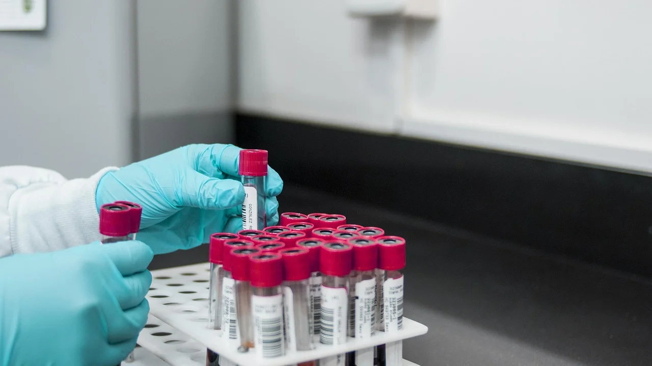 Profissional analisa amostra de sangue em laboratório clínico.