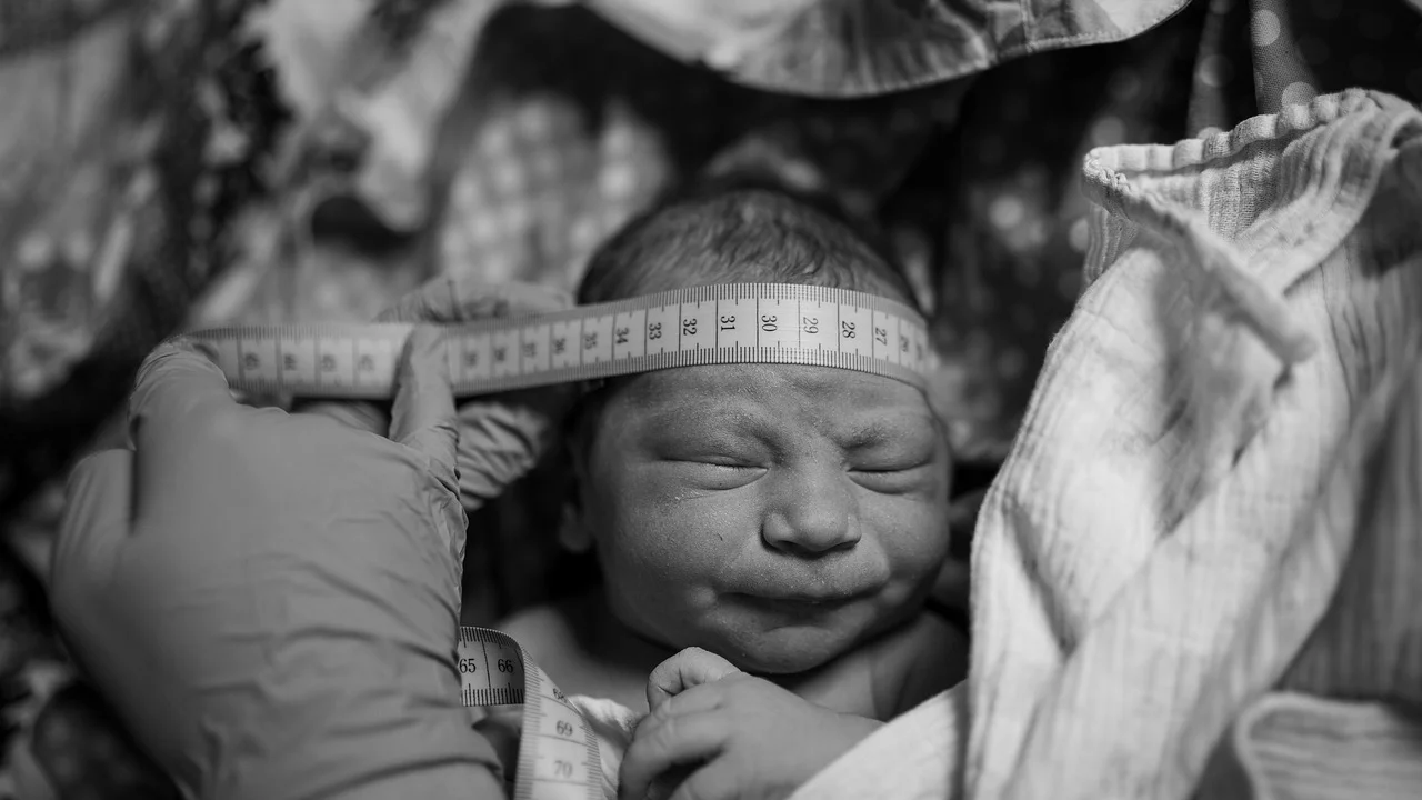 Profissional mede o perímetro cefálico de um bebê com fita flexível.