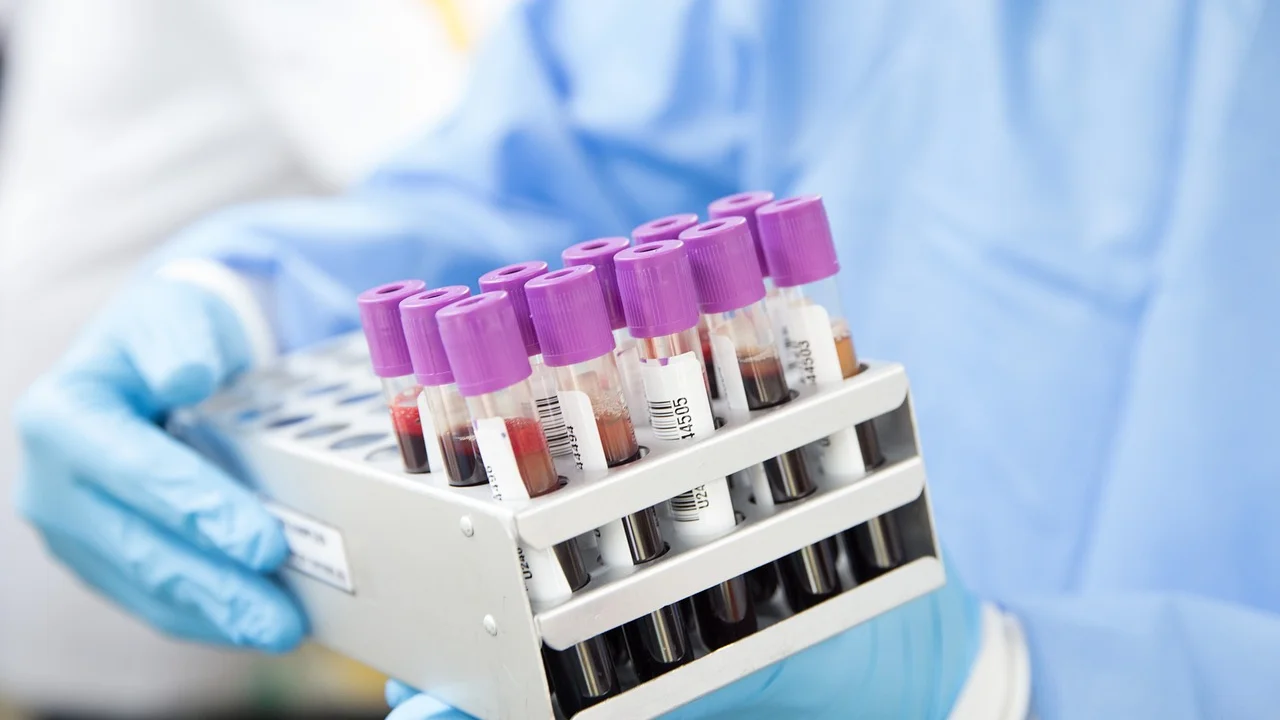Consulta médica para interpretação completa do hemograma